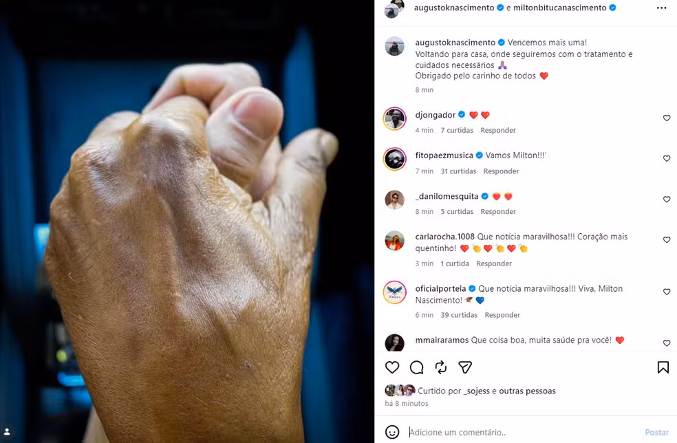 Milton Nascimento tem alta hospitalar após pneumonia: ‘Vencemos mais uma’, diz filho